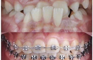 Lake Basin Dental & Orthodontics